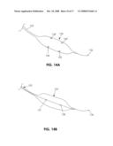 DEVICES AND METHODS FOR MEASURING THE SPACE AROUND A NERVE ROOT diagram and image