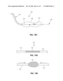 DEVICES AND METHODS FOR MEASURING THE SPACE AROUND A NERVE ROOT diagram and image