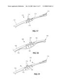 DEVICES AND METHODS FOR MEASURING THE SPACE AROUND A NERVE ROOT diagram and image