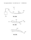 DEVICES AND METHODS FOR MEASURING THE SPACE AROUND A NERVE ROOT diagram and image