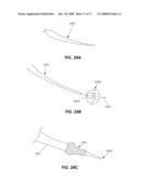 DEVICES AND METHODS FOR MEASURING THE SPACE AROUND A NERVE ROOT diagram and image