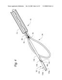 LEFT ATRIAL APPENDAGE CLOSURE diagram and image