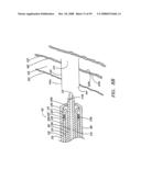 CLIP APPLIER AND METHODS OF USE diagram and image