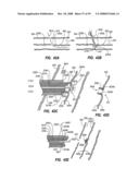 CLIP APPLIER AND METHODS OF USE diagram and image