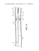 Infusion flow guidewire system diagram and image