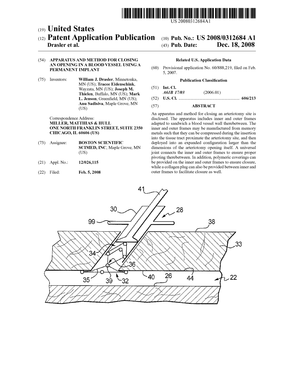 Apparatus and Method for Closing an Opening in a Blood Vessel Using a Permanent Implant - diagram, schematic, and image 01