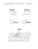 Apparatus and Method for Closing an Opening in a Blood Vessel Using a Permanent Implant diagram and image