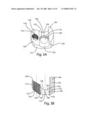 System and Method for Polyaxially Adjustable Bone Anchorage diagram and image