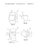 System and Method for Polyaxially Adjustable Bone Anchorage diagram and image