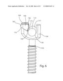 System and Method for Polyaxially Adjustable Bone Anchorage diagram and image