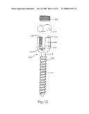 System and Method for Polyaxially Adjustable Bone Anchorage diagram and image