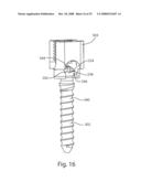 System and Method for Polyaxially Adjustable Bone Anchorage diagram and image