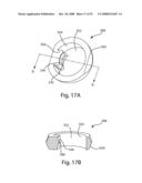 System and Method for Polyaxially Adjustable Bone Anchorage diagram and image