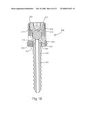 System and Method for Polyaxially Adjustable Bone Anchorage diagram and image