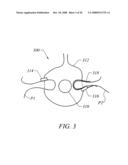 METHODS OF TISSUE RECONFIGURATION diagram and image