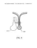 METHODS OF TISSUE RECONFIGURATION diagram and image