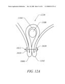 METHODS OF TISSUE RECONFIGURATION diagram and image