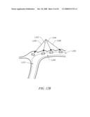 METHODS OF TISSUE RECONFIGURATION diagram and image