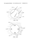 METHODS OF TISSUE RECONFIGURATION diagram and image