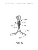 METHODS OF TISSUE RECONFIGURATION diagram and image