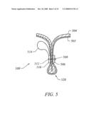 METHODS AND DEVICES FOR RECONFIGURING A BODY ORGAN diagram and image