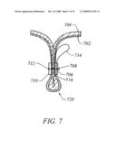 METHODS AND DEVICES FOR RECONFIGURING A BODY ORGAN diagram and image