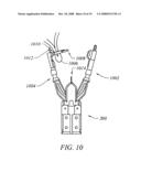 METHODS AND DEVICES FOR RECONFIGURING A BODY ORGAN diagram and image