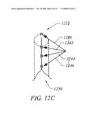 METHODS AND DEVICES FOR RECONFIGURING A BODY ORGAN diagram and image