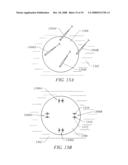 METHODS AND DEVICES FOR RECONFIGURING A BODY ORGAN diagram and image