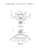 Flexible forehead support diagram and image