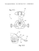 Flexible forehead support diagram and image