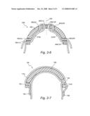 Forehead support for a facial mask diagram and image