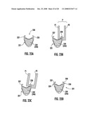 RIM AND BICYCLE WHEEL WITH WINGS WITH COMPENSATED FLARING diagram and image