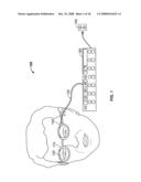 SYSTEM, APPARATUS, AND METHOD FOR CORRECTING VISION USING AN ELECTRO-ACTIVE LENS diagram and image