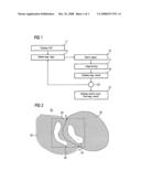 Method for interactively segmenting structures in image data records and image processing unit for carrying out the method diagram and image