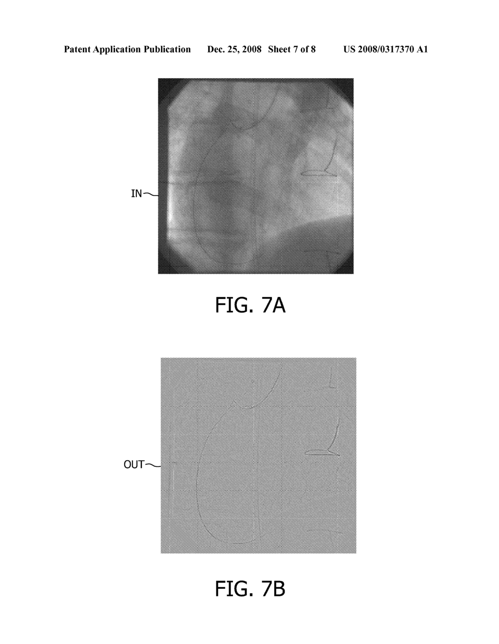 Method and System for Filtering Elongated Features - diagram, schematic, and image 08