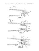 Vehicle front end module to grille connective arrangement diagram and image