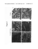 Compositions and methods for inhibiting growth of smad4-deficient cancers diagram and image