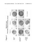 Compositions and methods for inhibiting growth of smad4-deficient cancers diagram and image