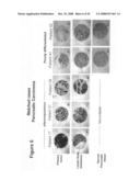 Compositions and methods for inhibiting growth of smad4-deficient cancers diagram and image