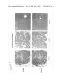 Compositions and methods for inhibiting growth of smad4-deficient cancers diagram and image