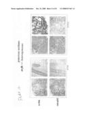 Compositions and methods for inhibiting growth of smad4-deficient cancers diagram and image