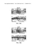 Method for Treating Skeletal Disorders Resulting from Fgfr Malfunction diagram and image