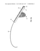 DENTAL DEVICE, SUCH AS A BRIDGE OR INSERT diagram and image