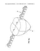 DENTAL DEVICE, SUCH AS A BRIDGE OR INSERT diagram and image