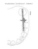 DENTAL DEVICE, SUCH AS A BRIDGE OR INSERT diagram and image