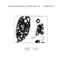 PSCA prostate stem cell antigen and uses thereof diagram and image