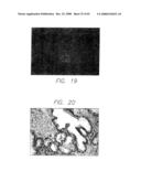 PSCA prostate stem cell antigen and uses thereof diagram and image