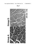 ISCHEMIA THERAPEUTIC AGENT diagram and image