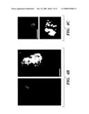 USE OF GABA AND GABAB AGONISTS diagram and image